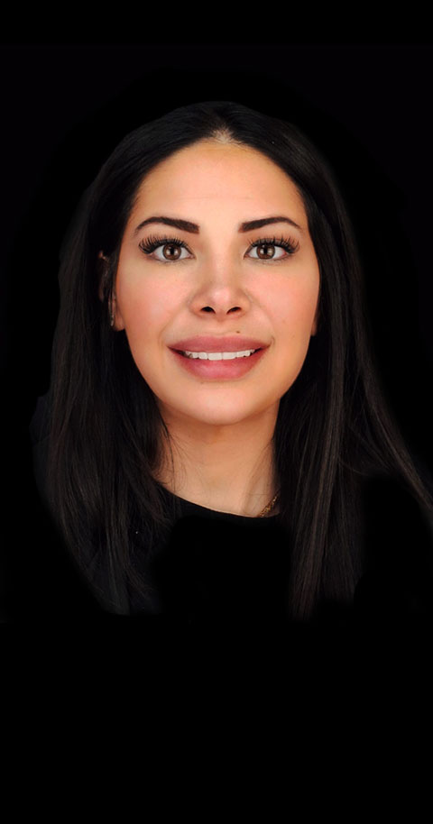 composite veneers in tijuana mexico