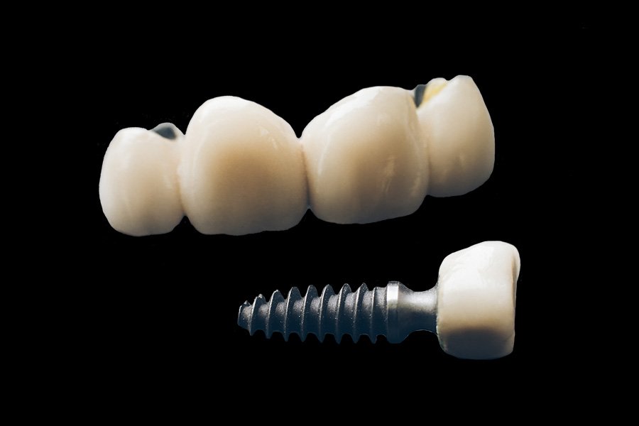 Same visit dental crowns Tijuana