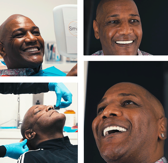 snap on dentures tijuana mexico from smile4evermexico.com