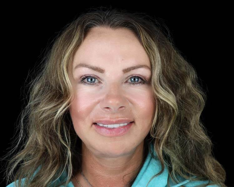 dental cleaning and whitening