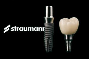 straumann implants